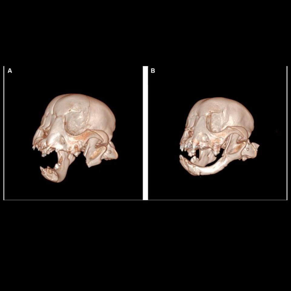 A scan taken after surgery, left, showed a large portion of the lower jaw missing. Eight weeks later, another scan, right, showed bone had regrown in the same spot.